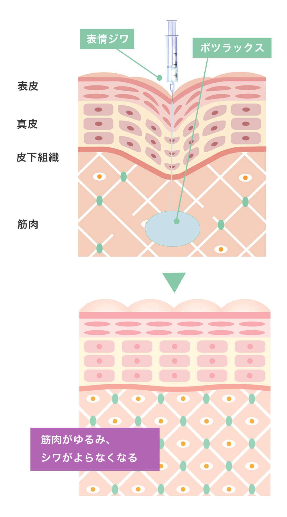ボツラックス
