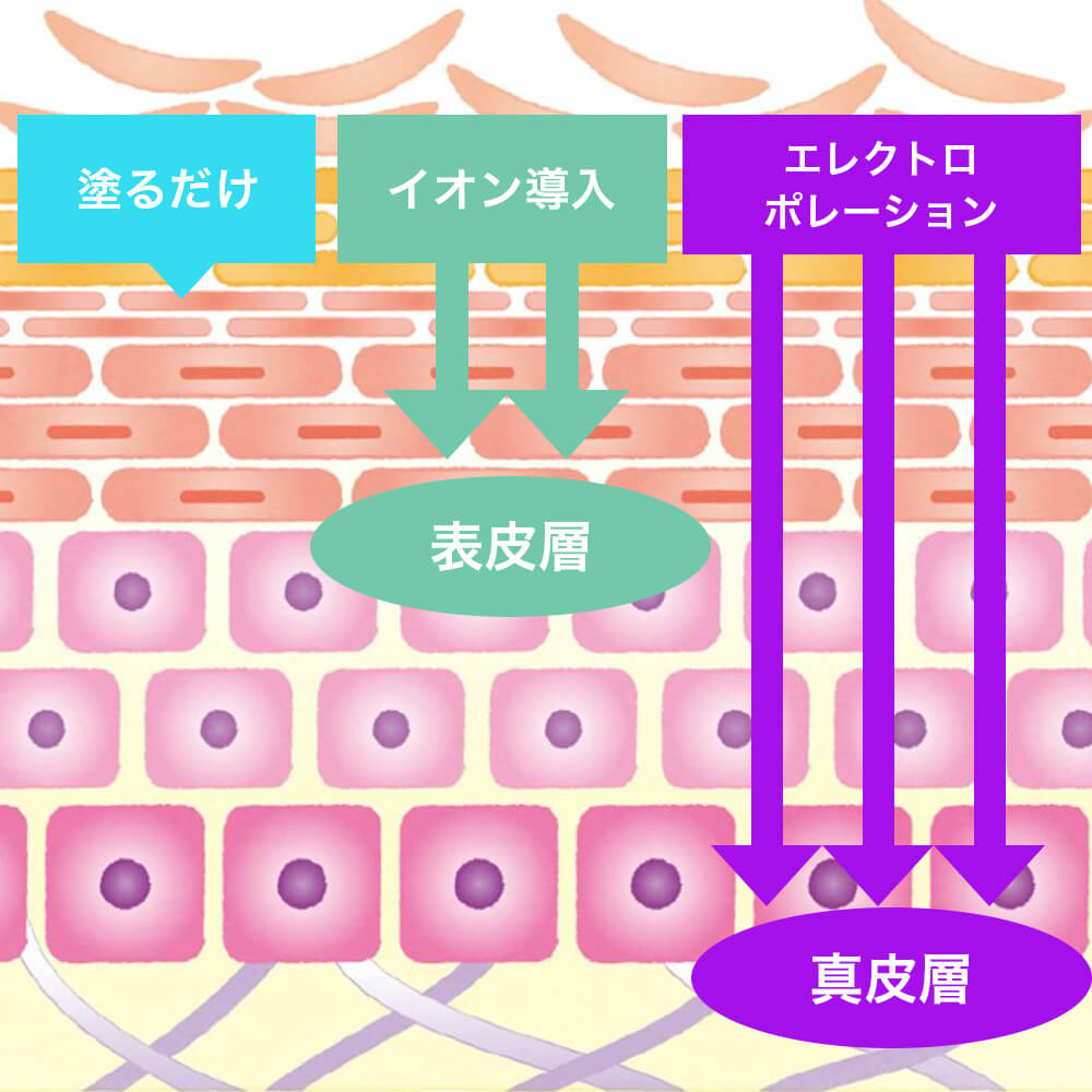 エレクトロポレーション