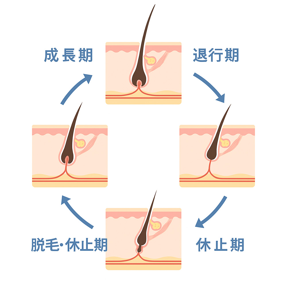 医療レーザー脱毛