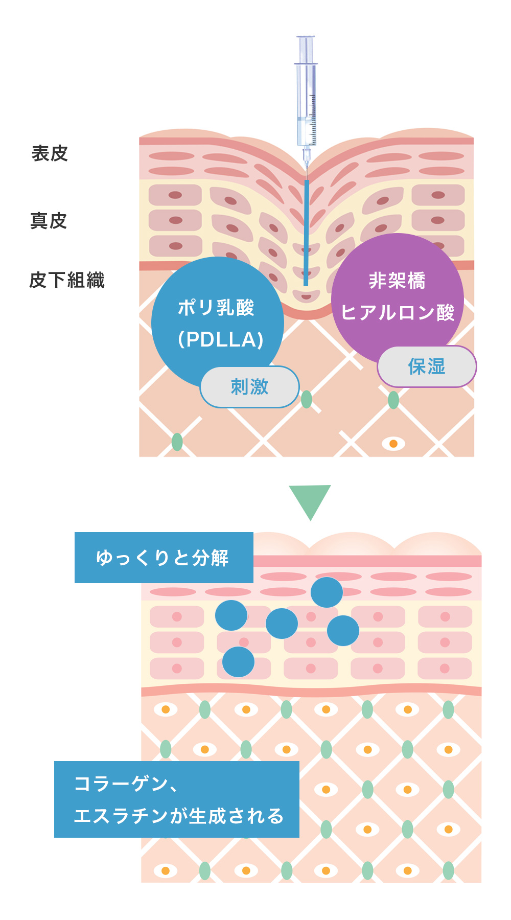 ジュベルック