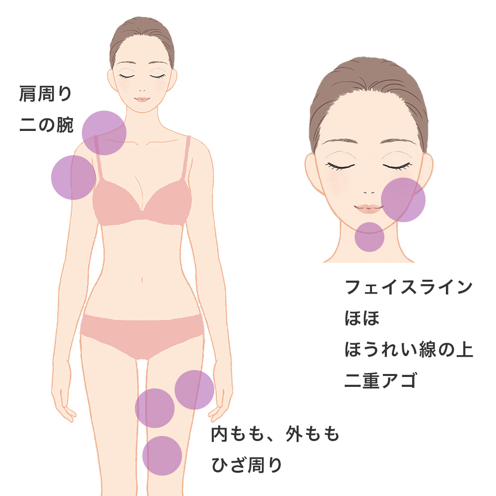 カベリン注射