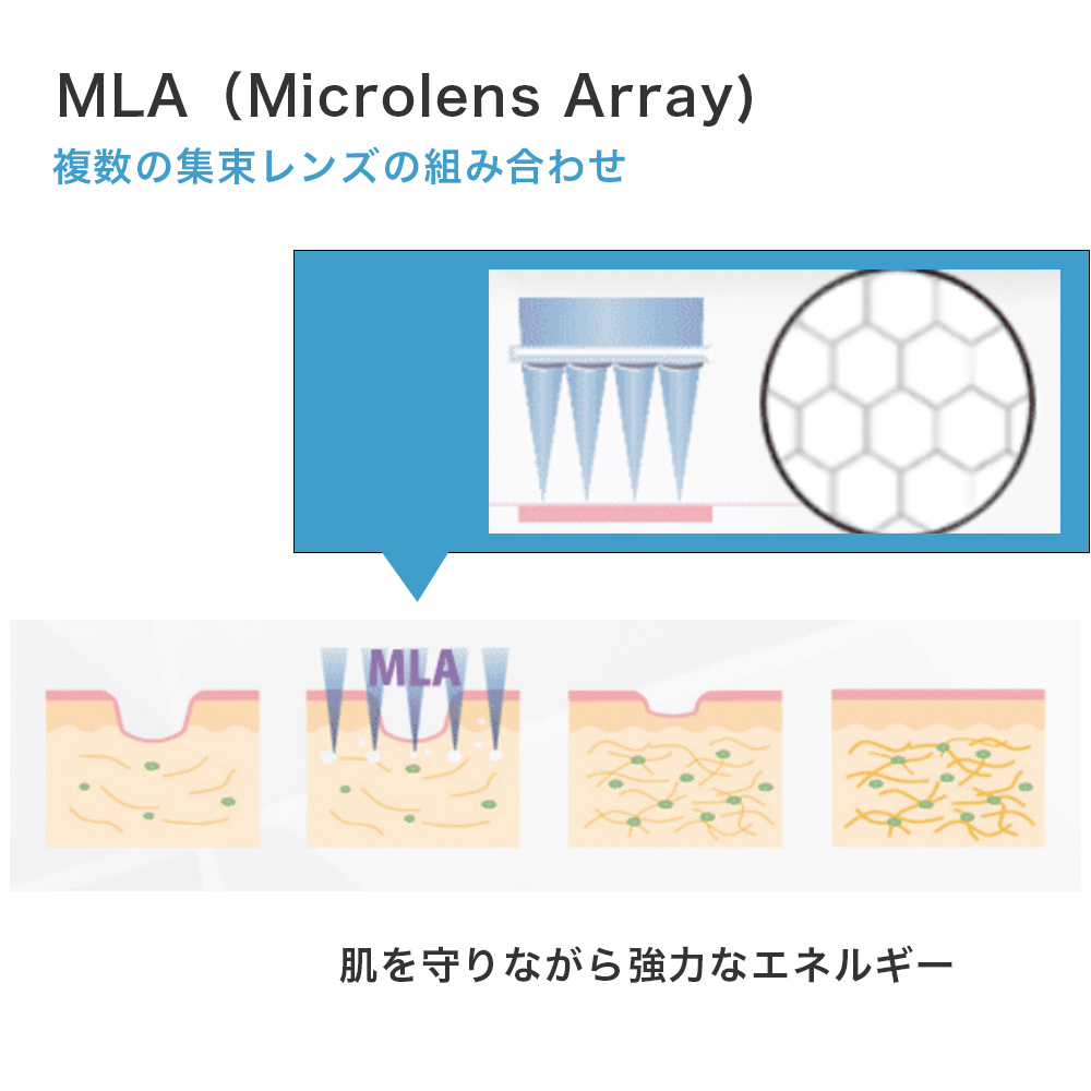 MLA
