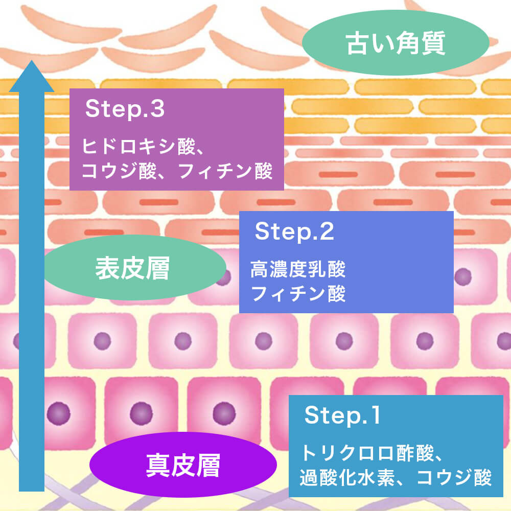 リバースピーリング