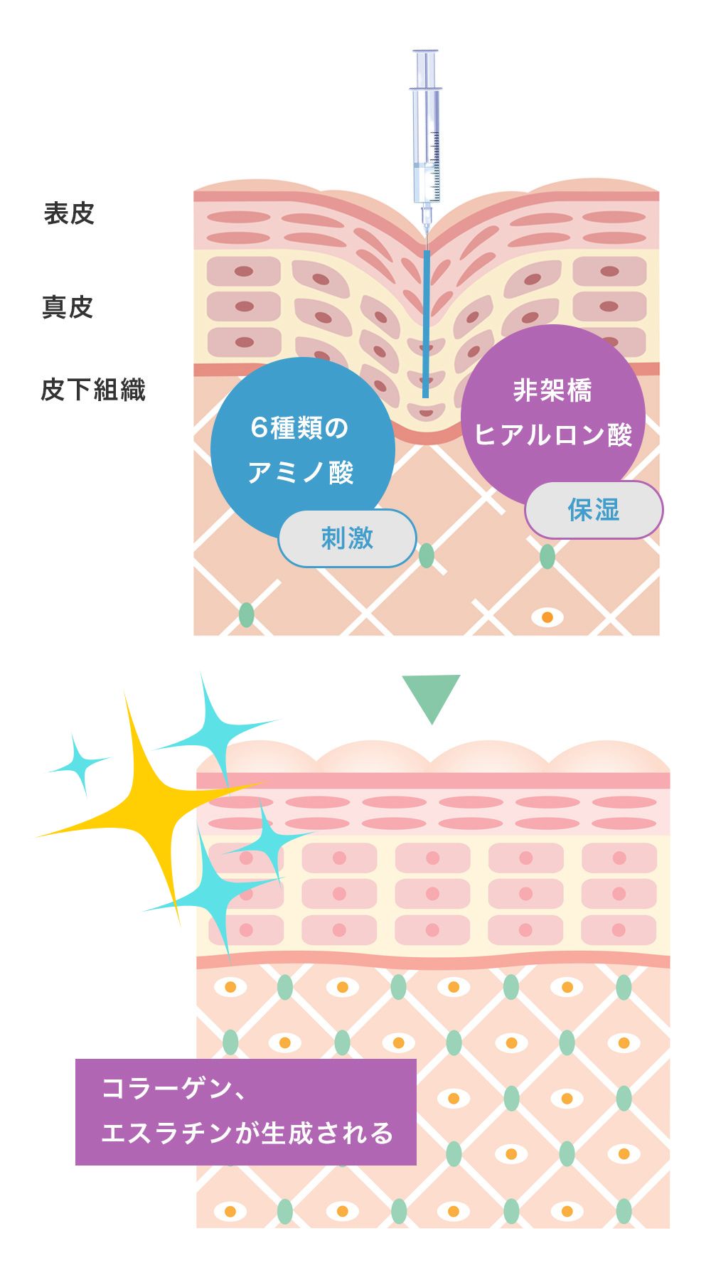 スネコス